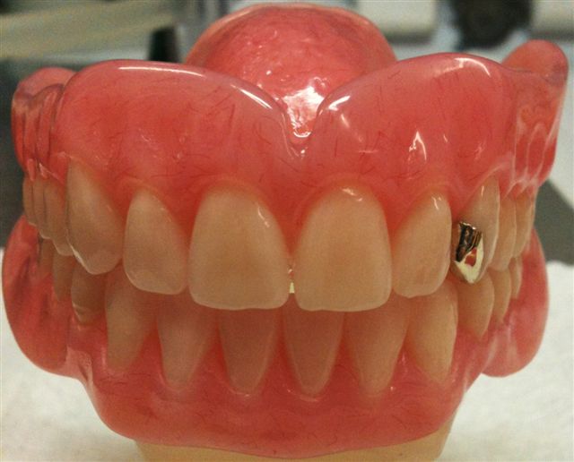 cosmetic-dentists-dental-clinic-denture-implants-repair-midland